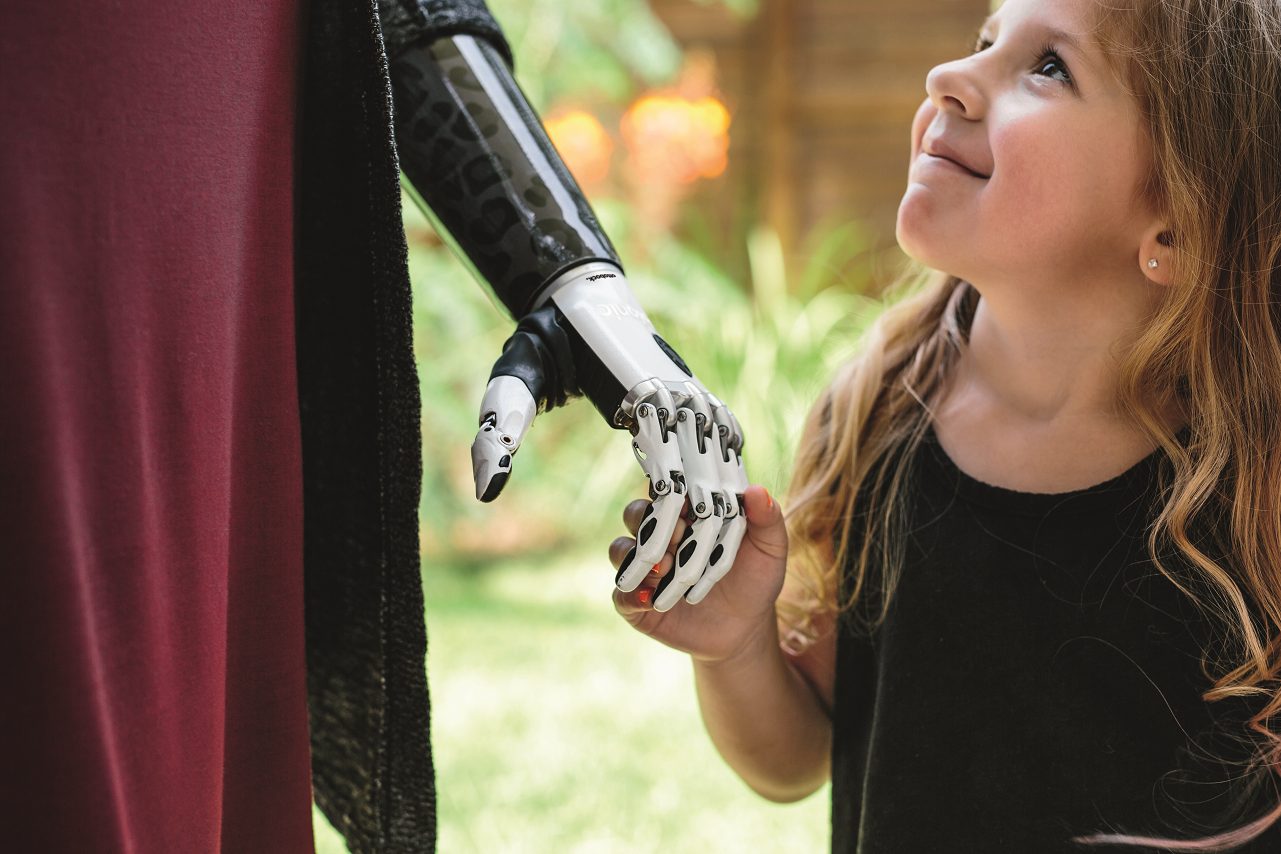 A smiling young girl reaching upward with her multi-articulating bionic hand.